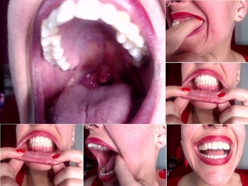 Hairless Mouth Tour With Dirty Teeth image