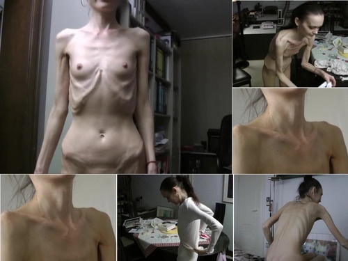 Anorexia SkinnyFans denisa ho9Km image