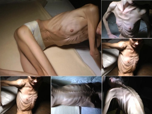 Anorexia SkinnyFans denisa k4c3X image