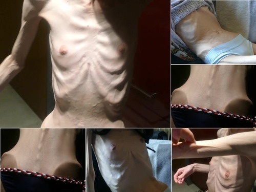 Anorexia SkinnyFans denisa 7b3X8 image