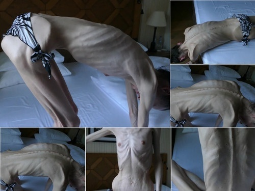 Anorexia SkinnyFans denisa g4Rwm image